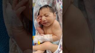 23 kg female child delivered with microcephaly 😍♥️viral shortvideo youtubeshorts [upl. by Portuna]