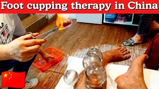 FOOT CUPPING MASSAGE  FOOT CUPPING THERAPY  HIJAMA CUP THERAPY  CHINESE FOOT CUPPING MASSAE [upl. by Clotilda]