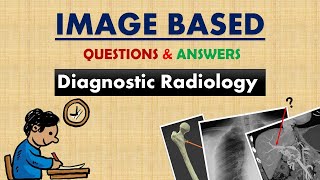 Image Based Questions amp Answers  Diagnostic Radiology  Radiology MCQs  Radiography QampA [upl. by Sacul]