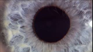 Close up of an Eye Reacting to Light Larger Pupil After Dilation [upl. by Nahij]