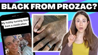 TIKTOK MANS SKIN TURNS BLACK AFTER PROZAC 😳 DERMATOLOGIST REACTS [upl. by Wons]