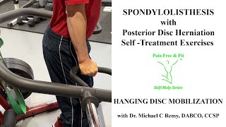 Spondylolisthesis with Disc Herniation Exercises When amp How to Anterior Pelvic Tilt w Hang Mobilty [upl. by Elleuqram713]