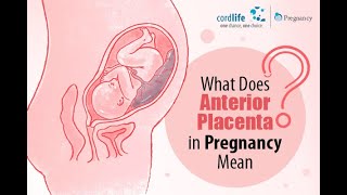 Anterior Placenta  common condition in pregnancy [upl. by Laise]