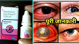 Moxifloxacin Eye Drops Uses in Hindi  Moxiford eye drop uses in hindi [upl. by Hux]