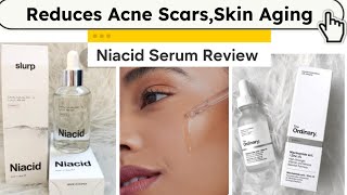 Niacinamide Serum  Niacid Serum  The Ordinary Niacinamide serum Review  Acne Scars serum  Niacid [upl. by Burrton]