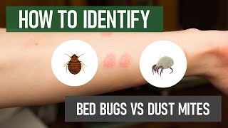 quotUnveiling the Hidden Truth Shocking Facts About Bed Bug Bites Revealedquot [upl. by Mathis]