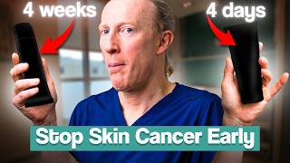 Prevent Squamous Cell Carcinoma SCC New 4Day Treatment EFUDIX ALTERNATIVE [upl. by Neral811]