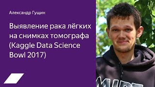 Kaggle Data Science Bowl 2017 выявление рака лёгких на снимках томографа — Александр Гущин [upl. by Socin]