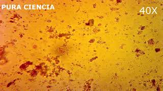 Giardia lambliaQuistes  Microscope 40x Lugol Coprológico  Pura Ciencia [upl. by Shieh]