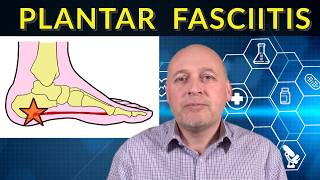 Plantar Fasciitis  THE TRUTH No Silly Instant Fix Claims [upl. by Llehsar]