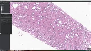 Annotate Glomeruli and Tubules using QuPath and Segment Anything Plugin [upl. by Piks]