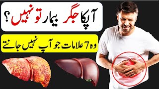 Jigar Ki Kharabi Ki Alamat  Jigar Kharab Hone Ki 7 Alamat  7 Early Signs Of Liver Failure In Urdu [upl. by Qidas430]