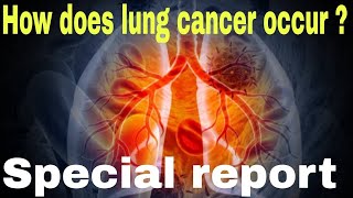 5 main reasons of lung cancer  how to care of lung cancer [upl. by Etnuaed74]