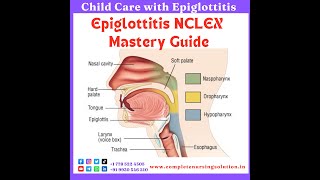 Epiglottitis For NCLEX epiglottitis education nursingexam nclexquestions nclexpreparation eaxm [upl. by Ibbor]