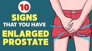 Enlarged Prostate BPH  Signs amp Symptoms  Every Man Needs to Know This [upl. by Jeralee693]