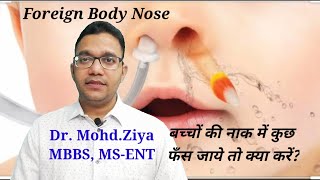 बच्चों की नाक में कुछ फंस जाये तो क्या करेForeign body nose removal in HindiForeign body nose [upl. by Sink]