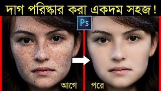 How to Quickly Smooth Skin and Remove Dark Spots Blemishes amp Scars Easily Photoshop Tutorial [upl. by Luane453]