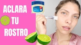 APLICA VASELINA CON LIMÓN Y ACLARA EL ROSTRO EN UN DÍA  PIEL DE PORCELANA [upl. by Marris149]