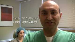 FACIAL LIPOSUCTION  DR TANVEER JANJUA  NEW JERSEY [upl. by Lipson]