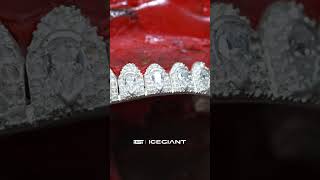 Processing custom icedout grillz with perm cut 🥶 [upl. by Crofoot41]