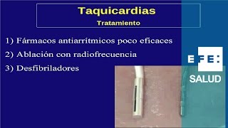 Tratamiento de las arritmias de taquicardia fármacos ablación y desfibrilador [upl. by Fachanan]