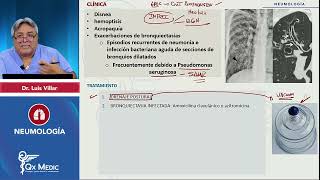 PI24 NEUMOLOGÍA Bronquiectasias Tratamiento de complicaciones [upl. by Manson]