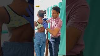 Scoliosis chiropractic treatment ☠️☠️ chiropractic chiro spine scoliosisawareness india short [upl. by Reddin]