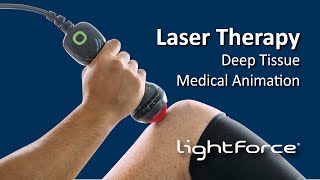 Laser Therapy  Deep Tissue Medical Animation [upl. by Clotilda28]