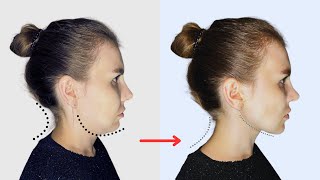 SLIM DOWN Your Face and Neck in JUST 30 Days [upl. by Vaules741]