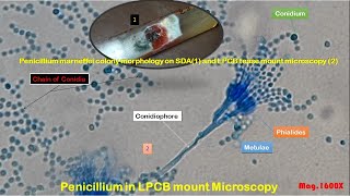 Penicillium marneffei colony morphology on SDA and LPCB tease mount Microscopy [upl. by Brenza]