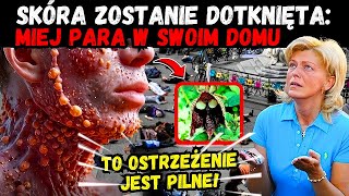 😱🚨 O MÓJ BOŻE  TA PLAGA DOTKNIE SKÓRY ZDOBĄDŹ TEN ARTYKUŁ TERAZ  ORĘDZIE MATKI BOŻEJ [upl. by Duval]