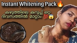 എത്ര കറുപ്പാണെങ്കിലും കറുപ്പിനെ മായ്ച്ചു കളയാം😄ഒരു തവണ use ചെയ്താൽ തന്നെ ഞെട്ടിപോകുന്ന മാറ്റം [upl. by Pontias]