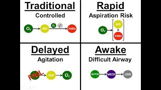 Introduction to Intubation  01  Approach Sequence [upl. by Wakeen37]