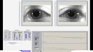 Eye Video Smooth Pursuit Horizontal 1Hzwmv [upl. by Aivad]