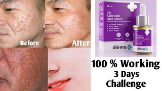 Reduce Black Spots  Acne Pimple MarksIn Just 3 Days  The Derma Kojic Acid Face Serum Review [upl. by Anisamot]