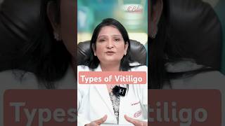 Types of Vitiligo  Vitiligo skin disease  Vitiligo Treatment in Ludhiana [upl. by Elsa]