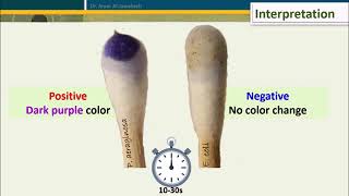 Oxidase Test Five Methods [upl. by Aihtenyc551]