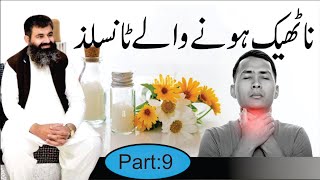 Tonsils  Causes amp treatment of Tonsils Infection  Homeopathic DRMMUNAWAR DAWOOD [upl. by Averyl692]