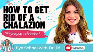 How to get rid of a chalazion What happens if a chalazion is untreated Can you pop a chalazion [upl. by Dimitry522]