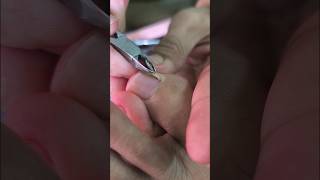 Nahirapan akong bunotin sa subrang laki ng ingrown satisfying pedicure nails satisfyingvideo [upl. by Gentry]