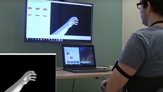 Virtual Reality Brings Pain Relief to Amputees [upl. by Nagiam]