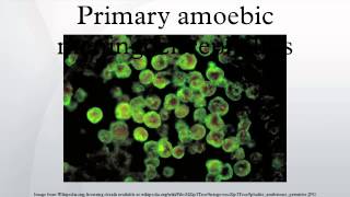 Primary amoebic meningoencephalitis [upl. by Rehptsirhc]