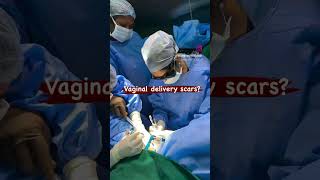 Vaginal delivery scar removal  Dr Deepa Ganesh  Cosmetic Gynecologist [upl. by Rotkiv303]