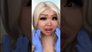 ASMR Botox Gone WRONG ‼️‼️ asmr tingly [upl. by Amada]