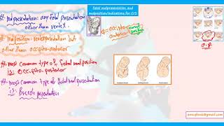 fetal malpresentation and malposition plus indications of cesarean section notes for AMC MCQ exam [upl. by Nmutua929]