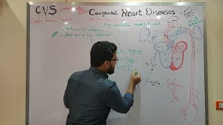 CVS Module  Congenital heart diseases part 1 [upl. by Sirama]