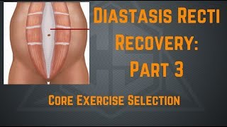 Diastasis Recti Recovery Part 3 Core Exercise Selection [upl. by Haduhey]