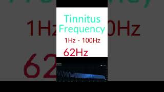 Pulsatile Tinnitus Frequencies 1Hz 100Hz [upl. by Borlow]