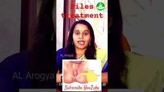 Piles மூலம் piles pilestreatment pilesrelief fistulatreatment [upl. by Alyak]