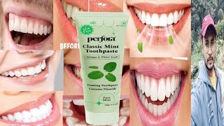 Perfora Classic Mint Toothpaste  Honest Review [upl. by Winola]